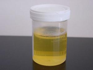 800px-Urine_sample.jpg