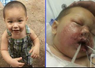 "Baby Bou Bou" before and after a Georgia SWAT team raided his home. (Family photos)